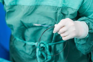 Interventionell-radiologische Techniken können in einigen Fällen chirurgische Eingriffe ersetzen.