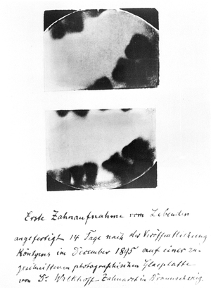 Bereits im Januar 1896, unternahm Otto Walkhoff (1860-1934) mit einer improvisierten Röntgeneinrichtung den Versuch, seine eigenen Zähne intraoral zu röntgen. Die notwendigen fotografischen Plättchen hatte er sich selber zugeschnitten. Die Expositionszeit betrug 25 Minuten. Nach dieser Pioniertat begann Walkhoff weiter an der Entwicklung der zahnmedizinischen Röntgendiagnostik zu arbeiten.